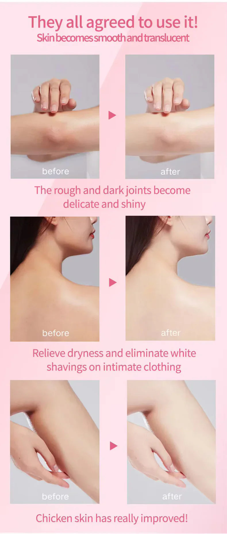 Niacinamide Body Whitening Cream 100gram